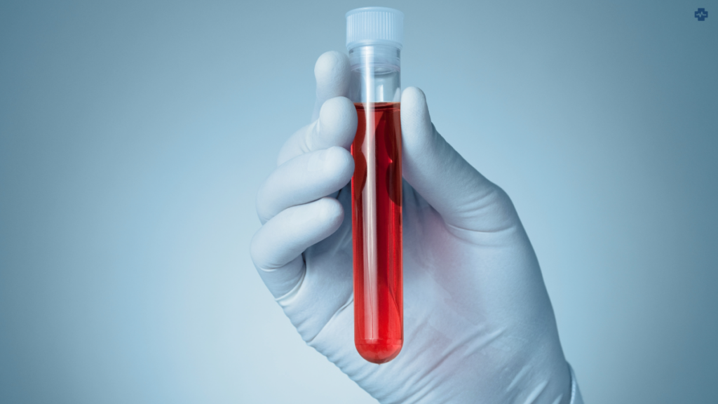 What Your Blood Tests Can Reveal: Unlocking the Secrets of Your Health
